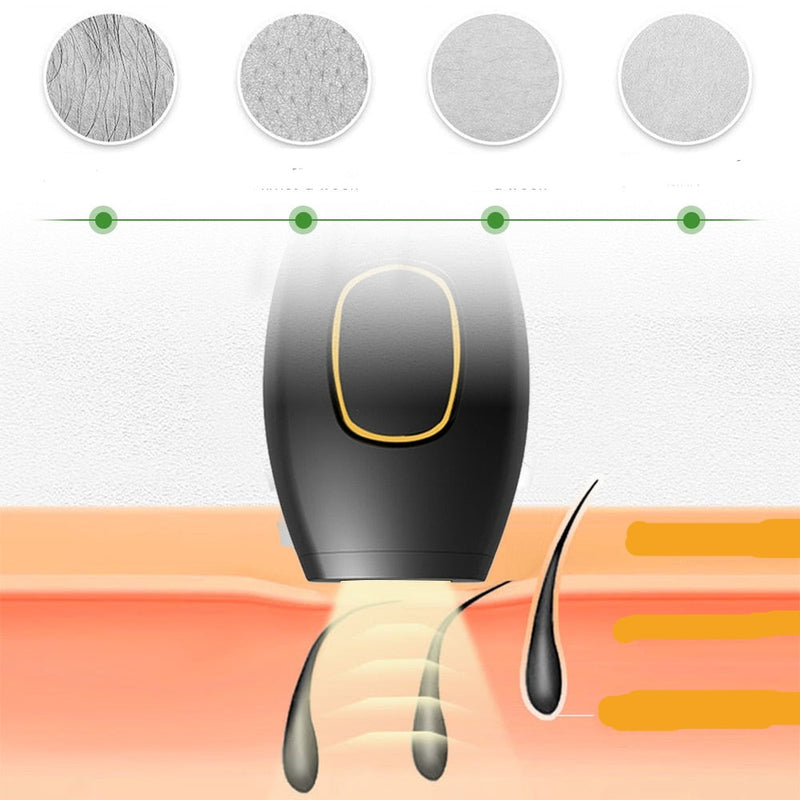 Depilador á laser portátil - JN ecomerce 